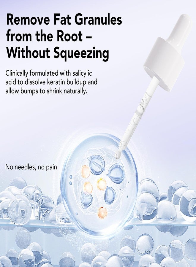 ديرمفري مزيل الدخينات 30 مل، علاج موضعي للدخينات مع حمض الساليسيليك، سيروم لتنقية البشرة من حب الشباب الدخيني - Image 2